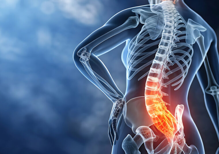 腰痛は手術なしで改善する？専門家が教える安全で効果的な改善法