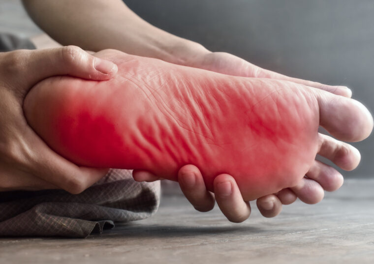 足底筋膜炎とは？『朝の一歩が痛い』その原因と対処法をわかりやすく解説